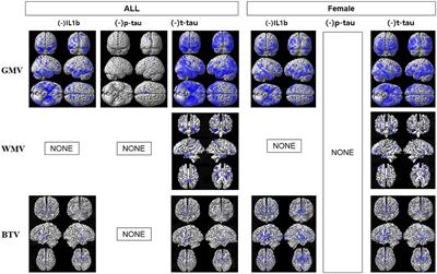 Correlation of brain tissue volume loss with inflammatory biomarkers IL1β, P-tau, T-tau, and NLPR3 in the aging cognitively impaired population
